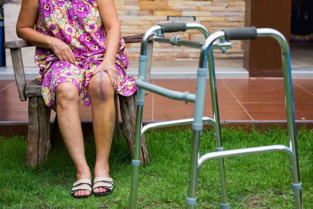 Useful Mobility Aids For Post Knee Or Hip Surgery Recovery Best Mobility Aids